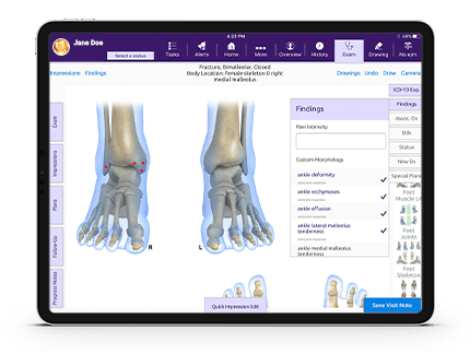 Screen showing the bones of the feet in EHR