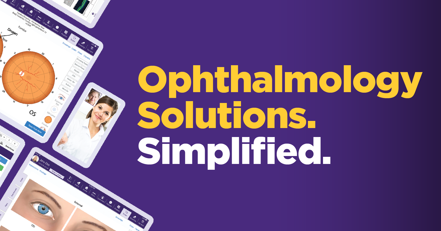 Ophthalmology solutions simplified Ophthalmology solutions simplified
