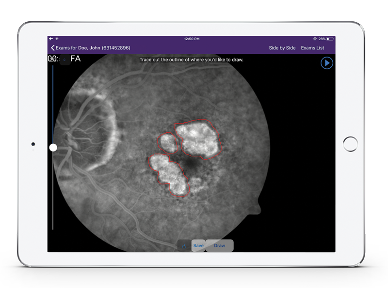 Ophthalmology image management annotation 