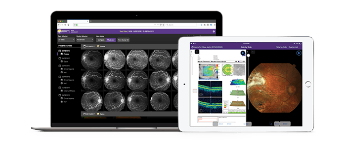 Retina Image Management