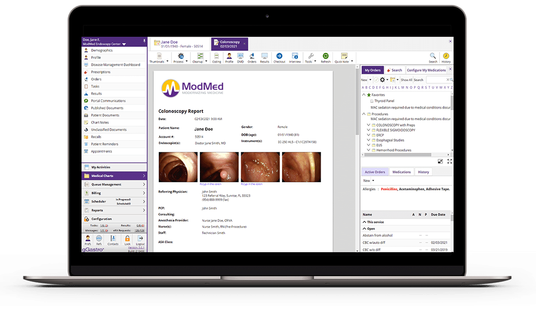 colonoscopy report displayed on laptop computer