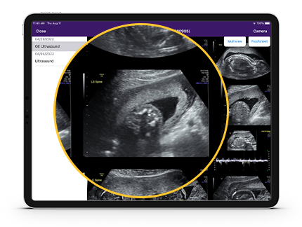 An image of ultrasound images.