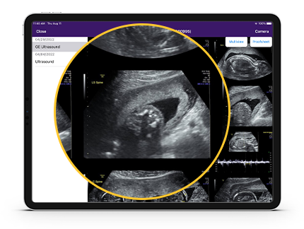 An image of ultrasound images.