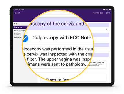A note showing that a colposcopy was performed.