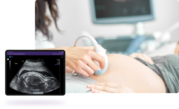 Ultrasound Ultrasound