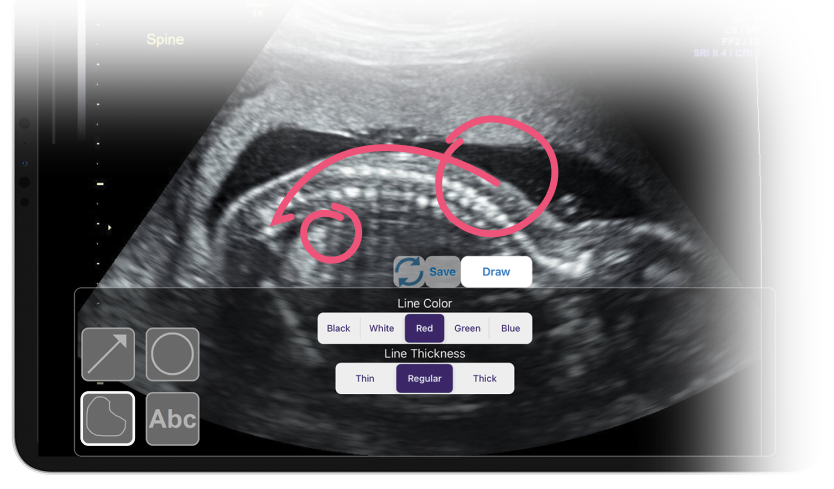 OBGYN Imaging With Marking