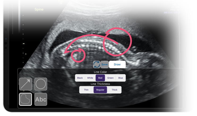 OBGYN Imaging With Marking OBGYN Imaging With Marking