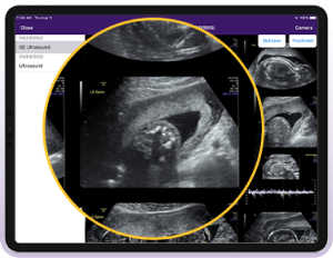 An image of ultrasound images.