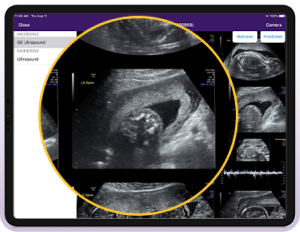 An image of ultrasound images. An image of ultrasound images.