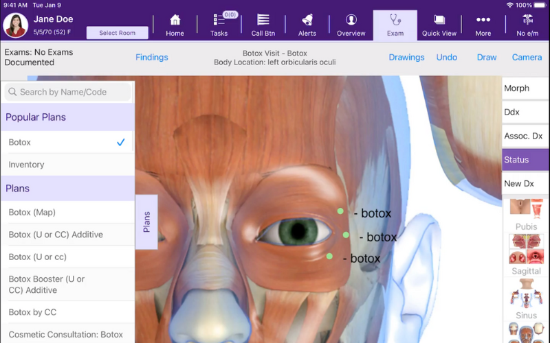 Viewing the location of botox injections through our anatomic atlas.