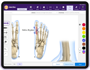 Hand-drawn annotations on skeletal diagram of a foot using EHR’s integrated drawing board