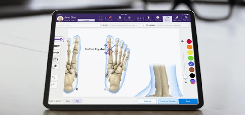 Diagram of bones in the foot on a tablet