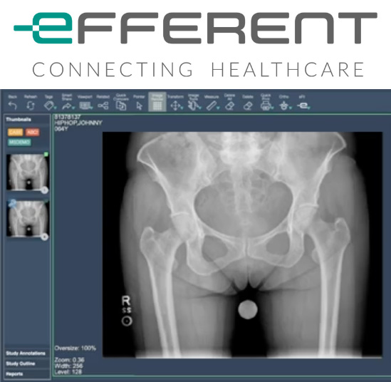 Efferent PACs imagery.