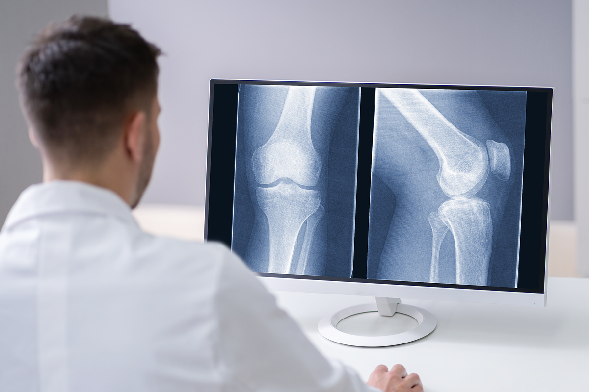 A physician at a workstation examines two X-ray images of a knee, using the imaging tools within the EHR system.