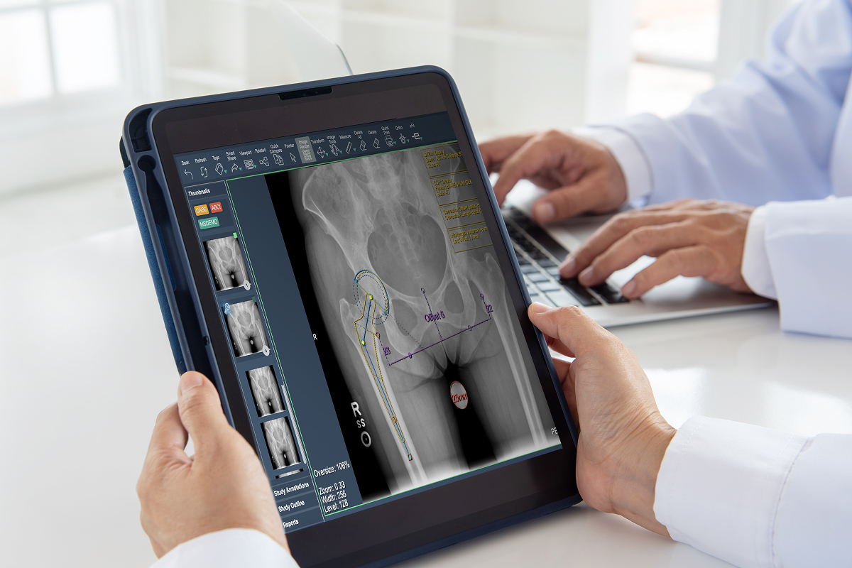 Image of practice team reviewing eVue PACS platform on iPad